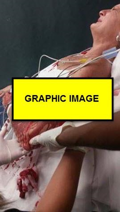 Gautrain responds to graphic images of woman’s attack