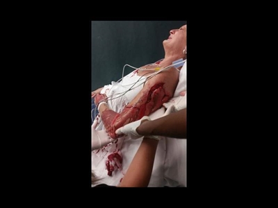 Centurion Gautrain attack confirmed