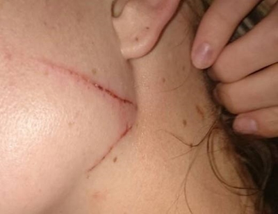 Mother and daughter survive attack in nature reserve