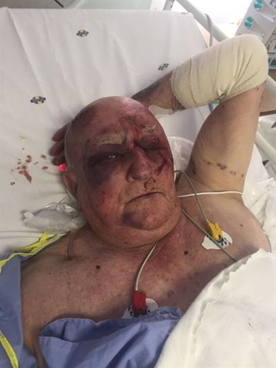 Farm attack puts 80-year-old in ICU