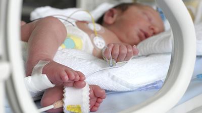 Knysna to celebrate World Premature Day