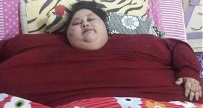 World's heaviest woman to fight for her life
