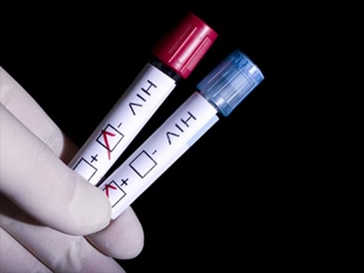 Pharmacies get go-ahead to sell Aids tests