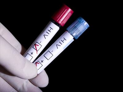 Pharmacies get go-ahead to sell Aids tests