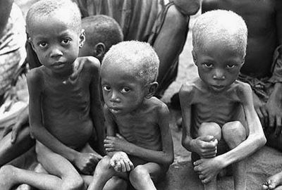 1.4 million African children at imminent risk of starvation