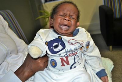 Baby’s arm amputated after drip