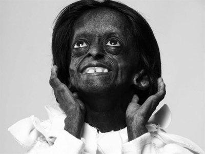 'Ontlametse represented much more than her illness'