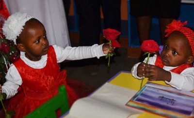 Conjoined twins separated in 23-hour surgery