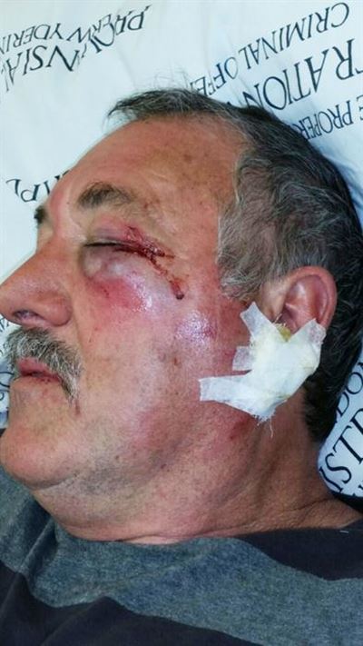 Man in hospitaal na aanranding